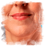 orofaciall-tratamentos-bigode-chines