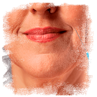 orofaciall-tratamentos-bigode-chines