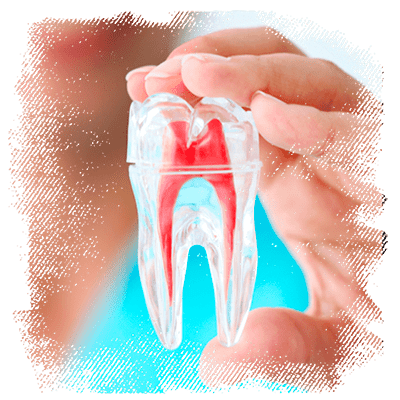 orofaciall-tratamentos-endodontia