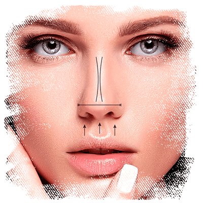 orofaciall-tratamentos-nosefactors