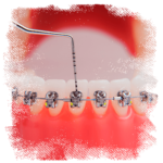 orofaciall-tratamentos-ortodontia