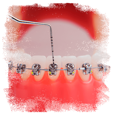 orofaciall-tratamentos-ortodontia